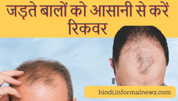 Baldness Treatment: जड़ते बालों को आसानी से करें रिकवर, अपनाएं केवल ये छोटे-छोटे 3 स्टेप्स