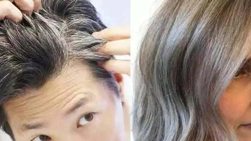 Hair Fall And Make Hair Stronger: हेयर फॉल को रोकने और बालों को मज़बूत  बनाने के 6 Tips - हिन्दी समाचार, Hindi breaking news, Latest hindi news -  Informalnewz hindi