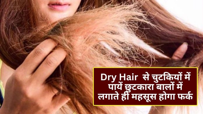 Dry Hair Solution: Dry Hair से चुटकियों में पायें छुटकारा बालों में लगाते ही महसूस होगा फर्क, अपनाइये ये घरेलू चीजें