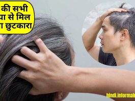 Amla For Hair Growth - हिन्दी समाचार, Hindi breaking news, Latest hindi  news - Informalnewz hindi