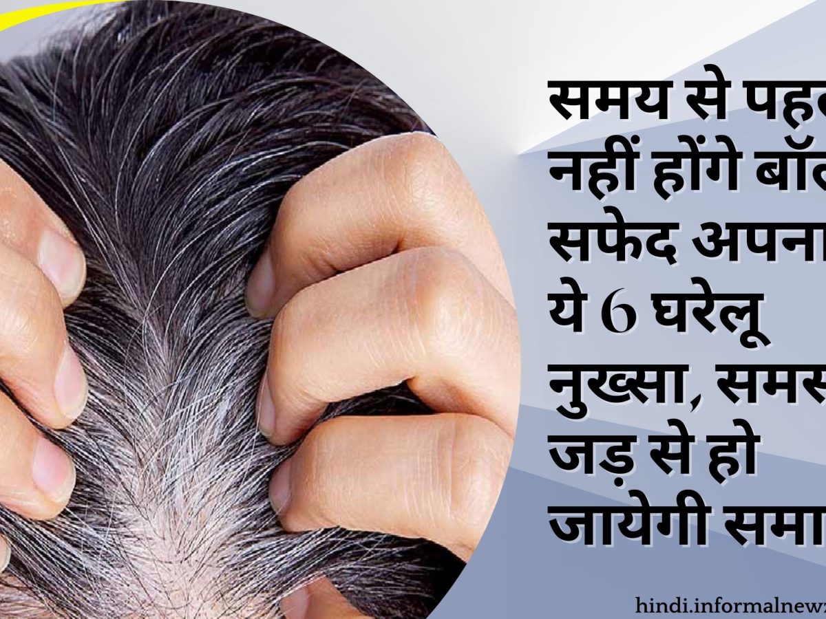 Ways to stop hair becoming white : समय से पहले नहीं होंगे बॉल सफेद अपनाइये ये 6 घरेलू नुख्सा, समस्या जड़ से हो जायेगी समाप्त - हिन्दी समाचार, Hindi breaking news, Latest Ways to stop hair becoming white : समय से पहले नहीं होंगे बॉल सफेद अपनाइये ये 6 घरेलू नुख्सा, समस्या जड़ से हो जायेगी समाप्त - हिन्दी समाचार, Hindi breaking news, Latest
