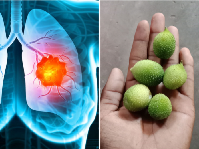 How to Prevent Lung Cancer: ये 3 चीजें धीरे-धीरे फेफड़े का कर सकती है खात्मा, हो सकती है कैंसर जैसी घातक बीमारी