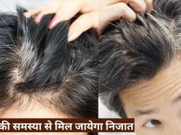 What Causes White Hair Patches And How It Is Treated? by avenues kapadia -  Issuu
