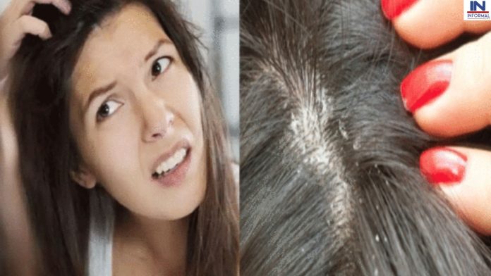 White hair and hair fall Solution: सफ़ेद बाल, हेयर फॉल ही नहीं डैंड्रफ और खुजली जैसी समस्या जड़ से हो जाएगी खत्म