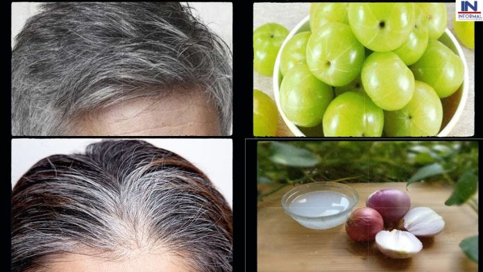 White Hair Best Home Remedies: किचन में रखी इन चीजों से दूर हो जायेगी बालों की सफेदी, बाल हो जायेंगे काले और चमकदार