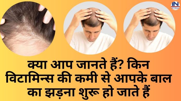 What is the Hair loss cause : क्या आप जानते हैं? किन विटामिन्स की कमी से आपके बाल का झड़ना शुरू हो जाते हैं, जानिए समस्या और समाधान दोनों