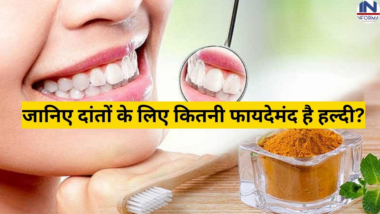 Teeth Whitening At Home very easily :  "दांतों के पीले पन से चुटकियों में पायें छुटकारा" अपनायें के घरेलू  नुख्सा