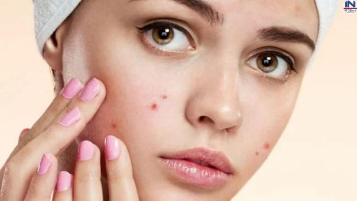 Monsoon Skin Care Best Tips: Keep the facial skin hydrated in this way during the rainy season, otherwise the face can become ugly