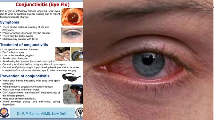 Eye Flu से हो जाएँ सावधान! इस राज्य में तेजी से फैल रहा है Eye Flu, तुरंत जानिए उपाय