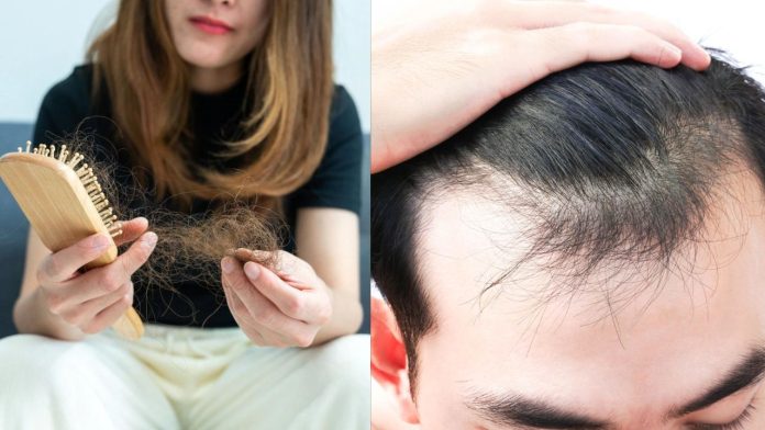 Hair Loss Reasons: क्या आप भी झड़ते बालों की समस्या से हैं परेशान? तो आज ही करना शुरू दें ये काम