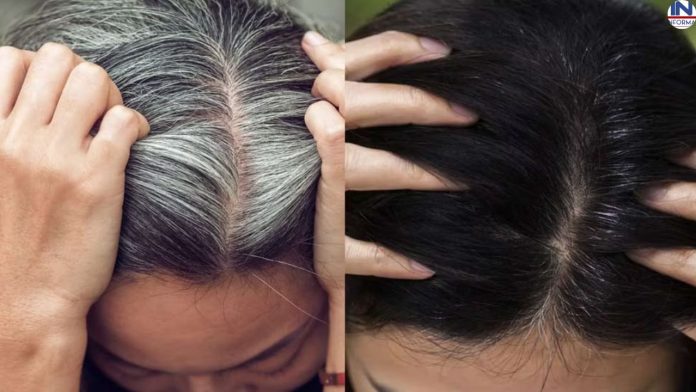How to ok white hair Problem: मिल गया सफेद बालों का रामबाण इलाज! आज से अपनाना शुरू कर दें ये नुस्खा, सप्ताह के अंदर नजर आएगा