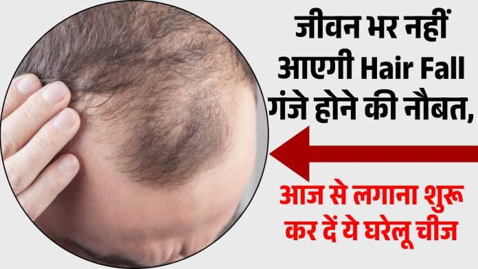 Home remedy to stop hair fall