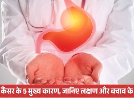 5 main causes of stomach cancer : पेट में कैंसर के 5 मुख्य कारण, जानिए लक्षण और बचाव के उपाय