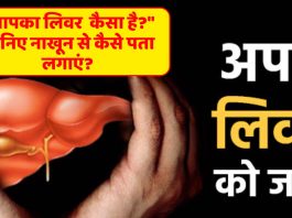 "आपका लिवर कैसा है?" जानिए नाखून से कैसे पता लगाएं , ये 5 लक्षण दिखाई दें तो समझ जाना कि....