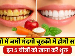 दांतों में सड़न और मसूड़ें होने लगे कमजोर तो आज ही अपनाएं ये घरेलू 5 नुख्सा, दांतों में जमी गंदगी चुटकी में होगी साफ