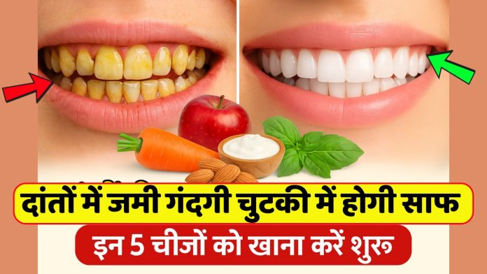 दांतों में सड़न और मसूड़ें होने लगे कमजोर तो आज ही अपनाएं ये घरेलू 5 नुख्सा, दांतों में जमी गंदगी चुटकी में होगी साफ