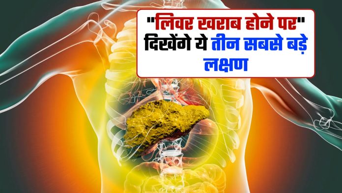Big Symptoms Of Liver Damage