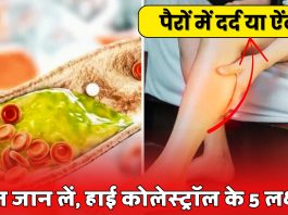 High Cholesterol Symptoms From Leg
